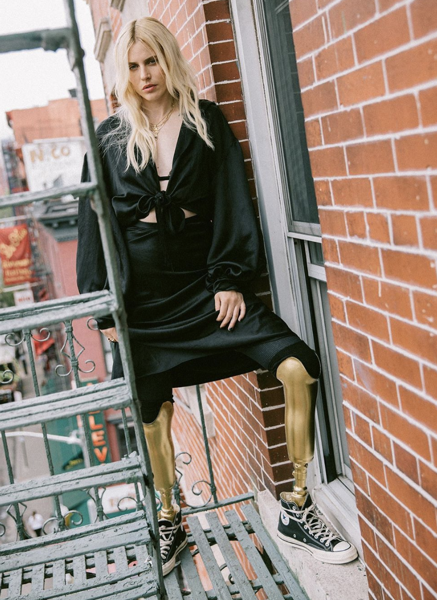 你的美只由你定義：4位超級模特兒的缺陷美